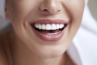 Highmoor-Dental-Veneers-downtown-edmonton-dentist_1